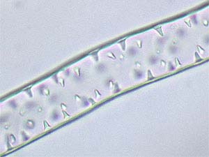 Pagina 4 di 9 Figura 10 - Rizoide "granuloso" di Lunularia cruciata. Diam. = 0,2 mm. Figura 11 - Talli di Lunularia cruciata e coppella con propaguli. Figura 12 - Propaguli in via di dispersione.