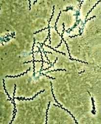 LEPTOSPIROSI Agente: Leptospira interrogans (Batterio) Serbatoi di infezione sono i suini, vari animali selvatici (topi) ma anche bovini ed equini.