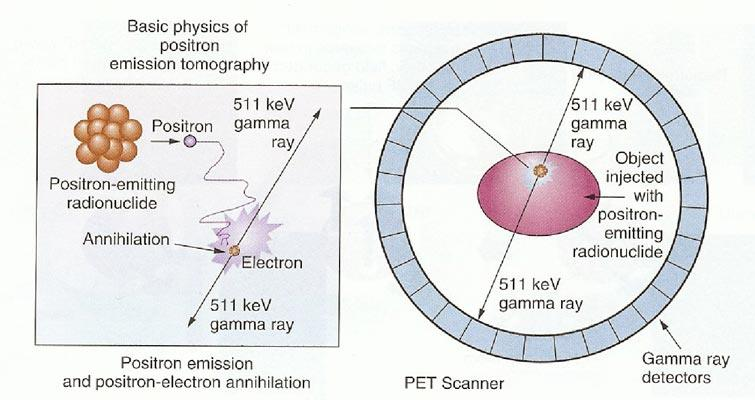 PET: Sfrutta radio-isotopi dall emivita brevissima come: Carbonio11,