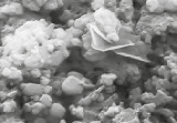 Il cristallo di fosfato tricalcico è il materiale del futuro della rigenerazione ossea, in quanto precursore osseo per accorciare