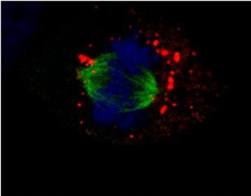 Microscopio confocale Ha le caratteristiche sia dell ottico sia dell elettronico e i campioni vengono analizzati utilizzando LUCE LASER Consente analisi