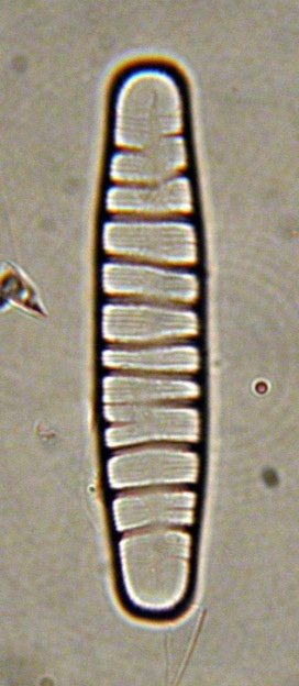 Bacillariophyceae inetressanti dell Riserva naturale di Torricchio Tra le diatomee osservate nella Riserva naturale di Torricchio, di grande interesse dal punto di vista