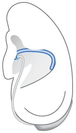 Può essere utile inserire l'apparecchio acustico di destra con la mano destra e l'apparecchio di sinistra con la mano sinistra.