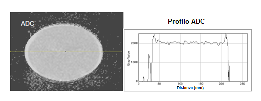 Figura 1.22 Valutazione dell uniformità dell ADC in un fantoccio (immagine a sinistra) con il relativo profilo (immagine a destra).
