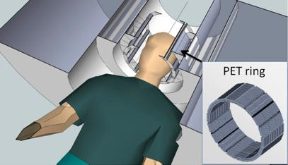 Diagnostica Rivelatori per PET/MRI EU-TRIMAGE: uno scanner trimodale (PET/MRI/EEG) per lo studio della schizofrenia