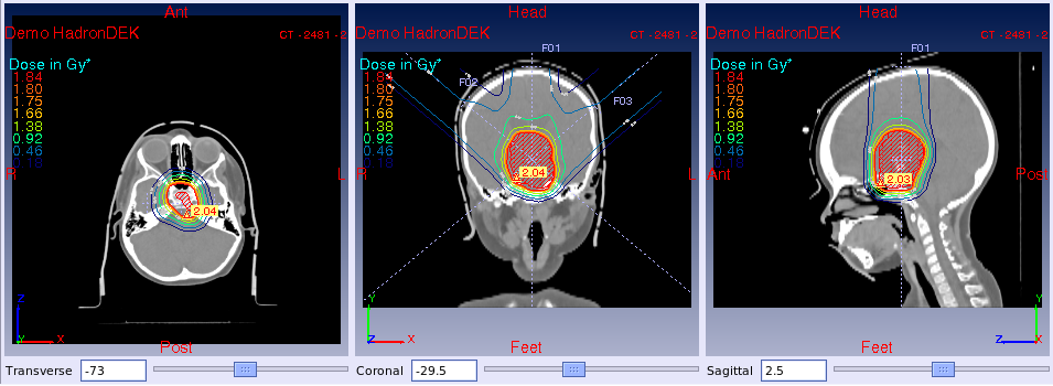 di: dose, RBE, LET, dose effettiva, sopravvivenza