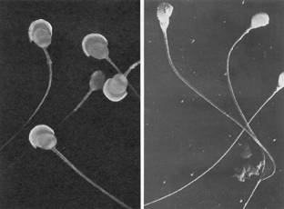 CIGLIA E FLAGELLI Le ciglia sono appendici cellulari lunghe dai 5 ai 10 µm, di diametro pari a circa 0,2 µm.