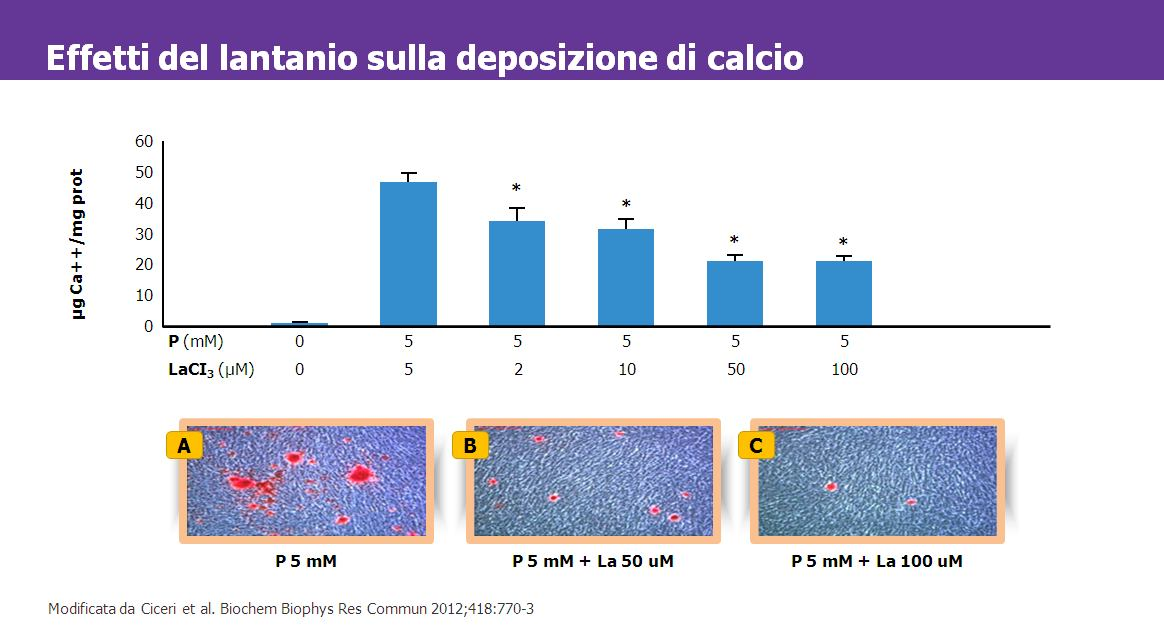 Cellule muscolari lisce vascolari sono state incubate con fosforo a 5 mm con concentrazioni crescenti di lantanio.