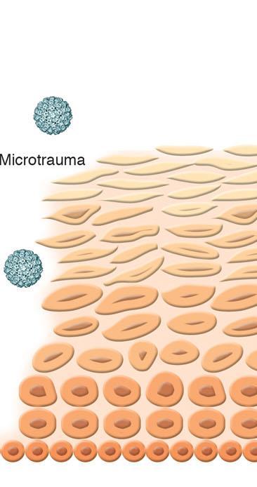 Meccanismo d azione Transudated Abs in Mucus* Cervical Mucus Y Exudated Abs at Sites of Trauma # Y