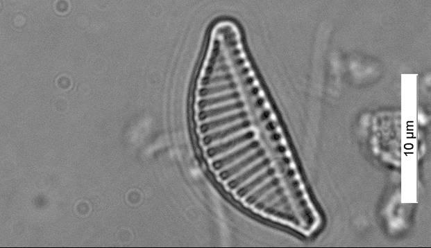 Figura 14. Caloneis amphisbaena Genere Cymbella Questo genere comprende molte specie, comuni in tutti gli ambienti acquatici, che colonizzano principalmente macrofite e massi.