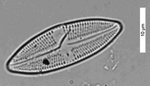 Figura 22. Navicula goeppertiana Navicula veneta Kutzing Dimensioni: lung. 13-30 μm, larg. 5-6 μm, numero di strie in 10 μm 13,5-15.