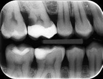 controllo di stabilità, in modo da garantire il perfetto funzionamento dell impianto. Quali tecniche radiologiche si utilizzano in odontoiatria?