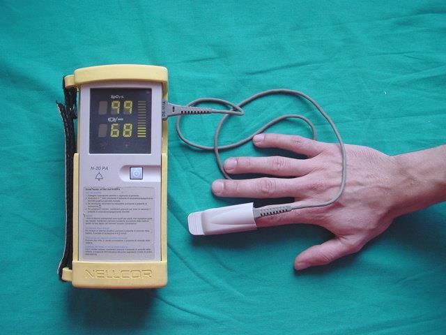 SATURIMETRO IL SATURIMETRO è uno strumento elettromedicale che permette di valutare, attraverso una sonda esterna, quindi in modo non invasivo, la percentuale di ossigeno legato all emoglobina