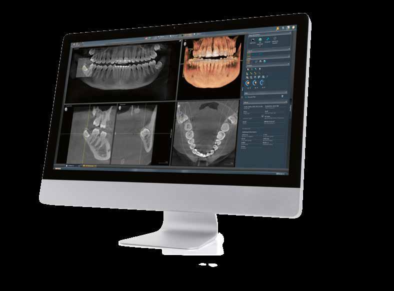 visualizzare rapidamente, in qualunque momento e senza interruzioni, tutte le immagini del paziente dalle immagini 2D a quelle 3D o riprese della telecamera intraorale.