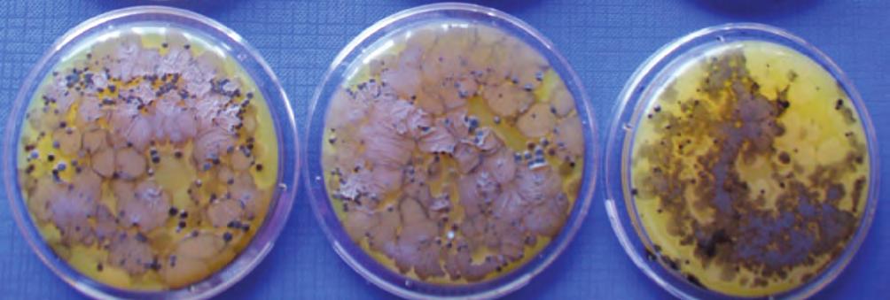nere Enterobacteriaceae (Figura 21 e Figura 22) e nello specifico Enterobatteri produttori di betalattamasi ad