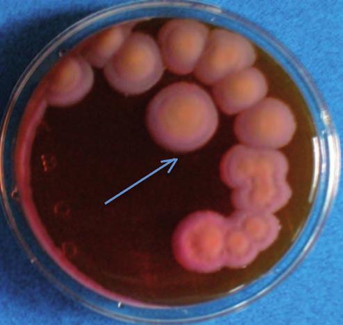 L E.coli fermentano il lattosio dando colonie circondate da un alone di sali biliari precipitati, reazione dovuta all azione degli acidi prodotti dalla fermentazione del lattosio sui sali biliari ed