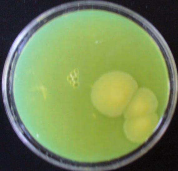 Colonie colore rosso: Enterobacteriaceae Figura 22: Rodac con terreno MAC CONKEY AGAR. Colonie colore rosa-gialle: Klebsiella spp.