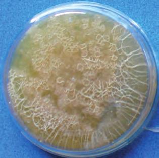 Ceppo microbico Condizioni di coltura Caratteristiche di crescita Staphylococcus aureus ATCC 6538 37 ± 1 C Dimensioni medie, colonie leggermente giallastre Microccoccus spp.