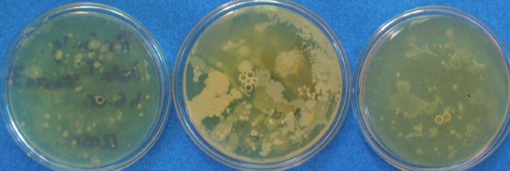 Figura 10 - Colonie di Bacillus spp. Figura 11 - Colonie di Bacillus spp. Figura 12 - Colonie di Bacillus spp.