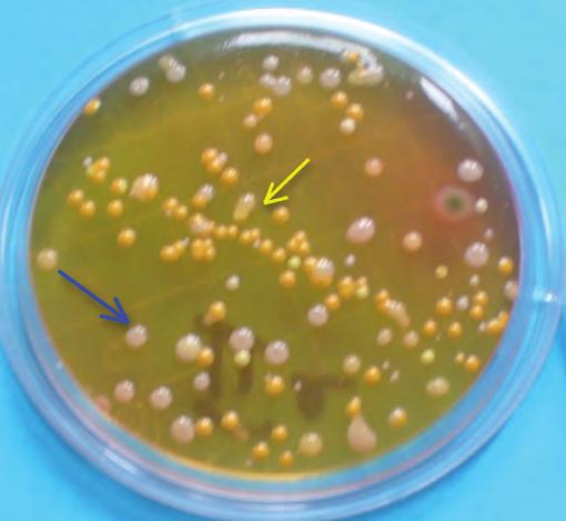 Figura 14 - Rodac con terreno MANNITOL SALT AGAR. Colonie piccole gialle: colonie di cocchi Staphylococcus species (spp.) coagulasi negativi (freccia gialla).