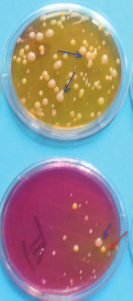 Figura 15 - Rodac 1 con terreno MANNITOL SALT AGAR: Le colonie beige più grandi sono Bacillus spp.
