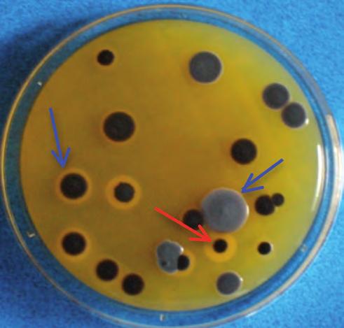 epidermidis, appartengono saprofiti normalmente presente sulla cute umana. Nelle Figure 16, 17, 18, 19 e 20 è possibile osservare colonie di Staphylococcus aureus e di Bacillus che si sono formate.