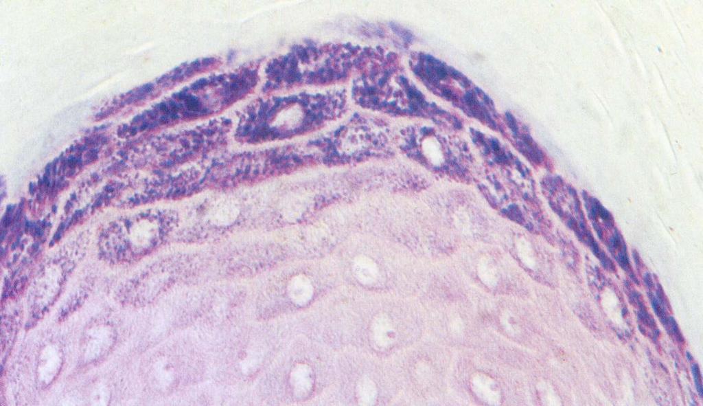 EPIDERMIDE STRATO GRANULOSO Cheratinociti 3-5 strati di cellule