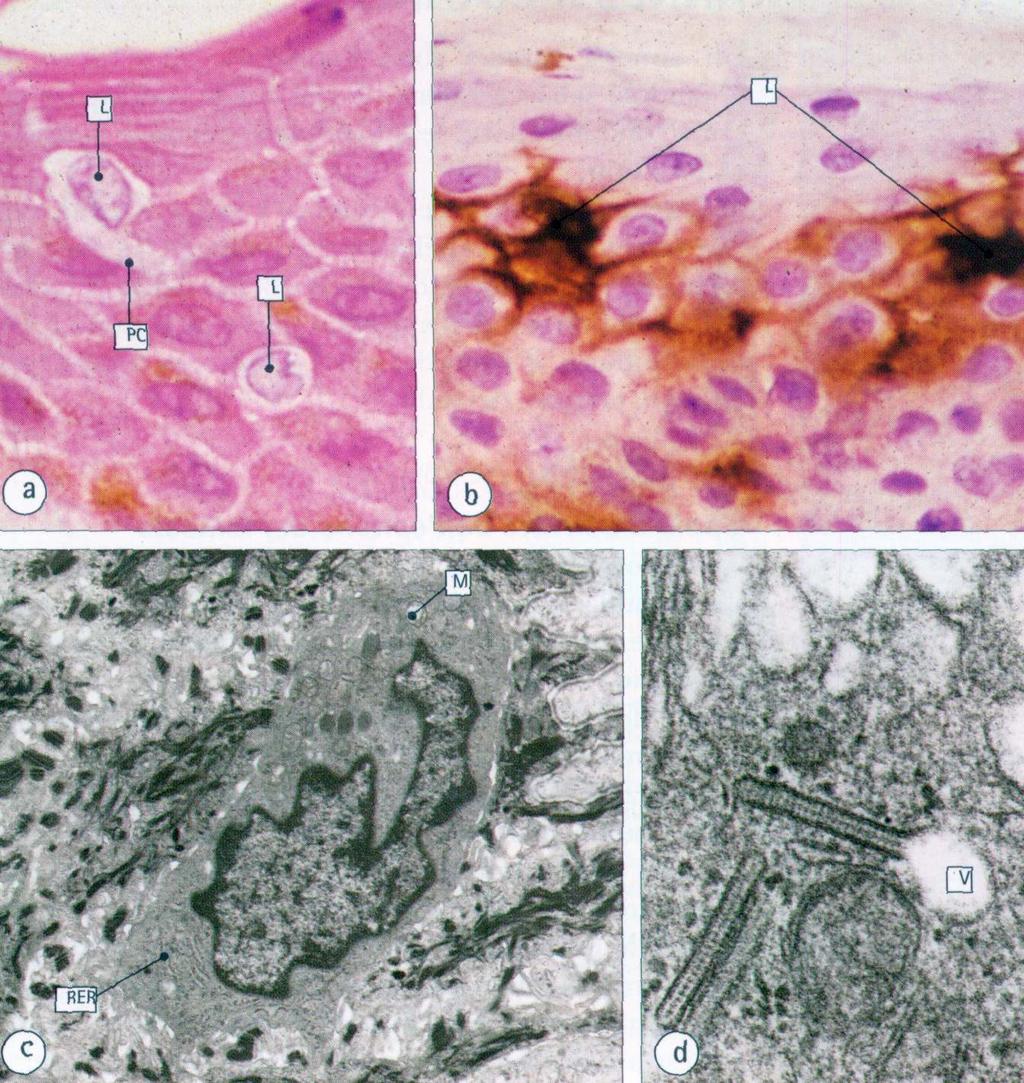 EPIDERMIDE ALTRI TIPI