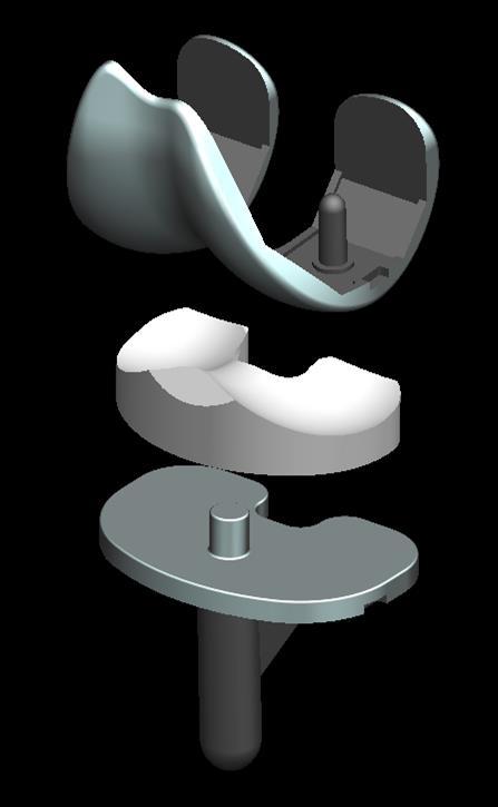 Il componente tibiale della protesi GSP è del tipo a menisco mobile (mobile bearing) Il razionale delle protesi a menisco mobile è: - Suddividere il movimento articolare su due superfici di