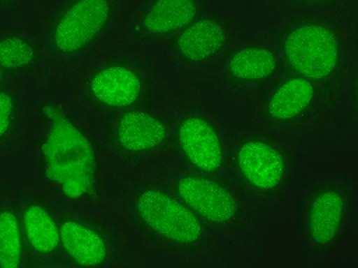 IMMUNOFLUORESCENZA INDIRETTA (IFI) TEST I I livello ANA (IFI):