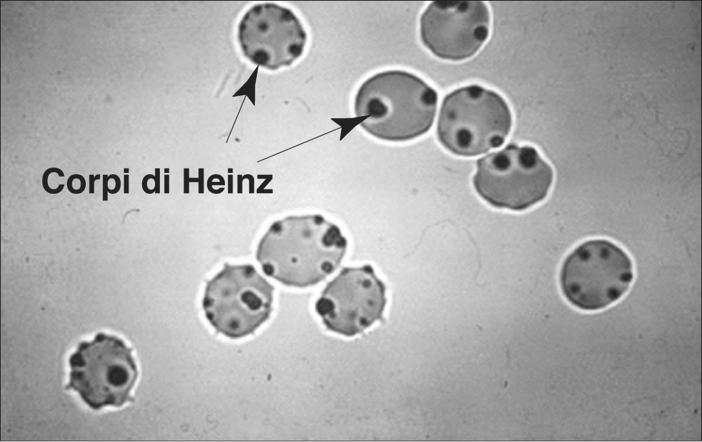 Il gene per questo enzima si trova sul cromosama x In individui con carenza di G6PD Farmaci ossidativi Antibiotici Antimalarici