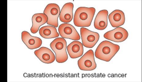 castrazione Proliferazione e sviluppo del CRPC ADT: androgen deprivation therapy Iperespressione degli enzimi per la