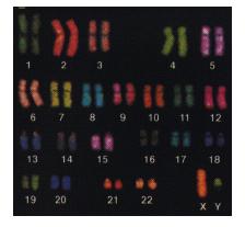 Analisi cariotipica spettrale Ibridazione In Situ Fluorescente ( FISH ) 24 sonde DNA