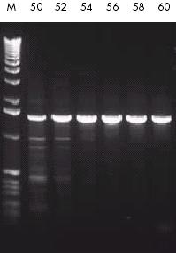 Ottimizzazione della reazione di PCR Temperatura di Annealing dei primers.