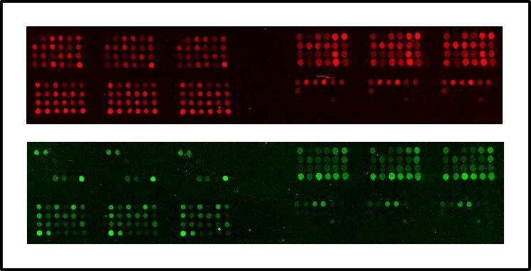 L innovazione tecnologica: il Gene-chip Frammenti di PCR contenenti gli esoni DMD sono spottati in triplicato su ogni array (altosinistra: esoni 1-24, alto