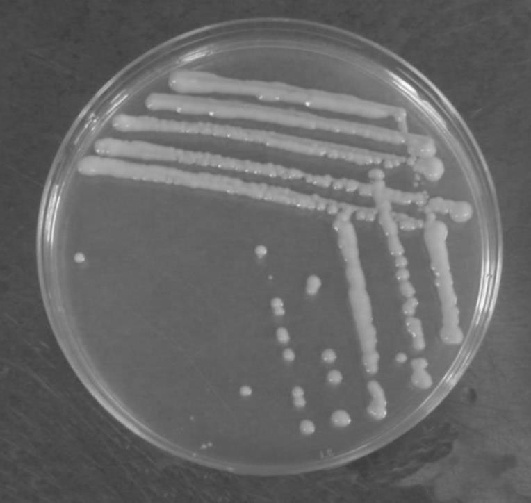 Foto 7. Isolato M861/10a di Saccaromices cereviseae Prove preliminari in beuta Idrolisi: Per l idrolisi sono stati utilizzati due enzimi acquistati da Sigma Aldrich: Celluclast 1.