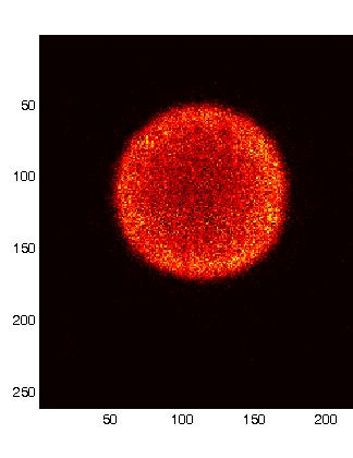 Applicazione della gamma camera HICAM in sperimentazione clinica Capitolo 4 Figura 4.13 