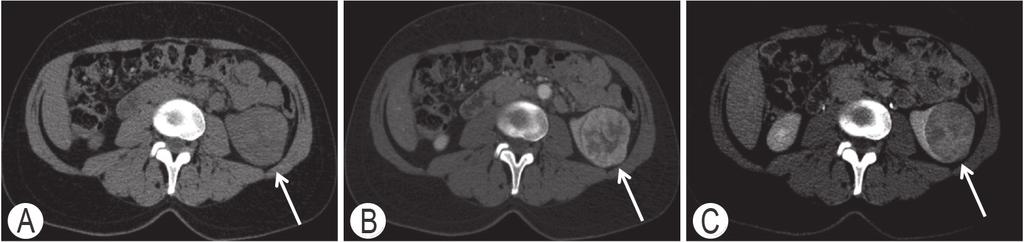 Diagnostica per immagini e stadiazione clinica 35 Aspetti TC.