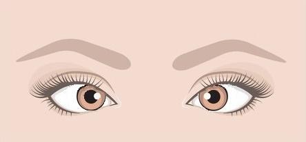 Quando la condizione di ortoforia non si verifica è rilevabile una deviazione che può essere: - latente: quando l attività fusionale compensa l errore di allinemanto e gli occhi presentano un aspetto