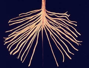 CAUDA EQUINA Insieme delle radici degli ultimi nervi spinali che devono raggiungere i fori corrispondenti per originare il