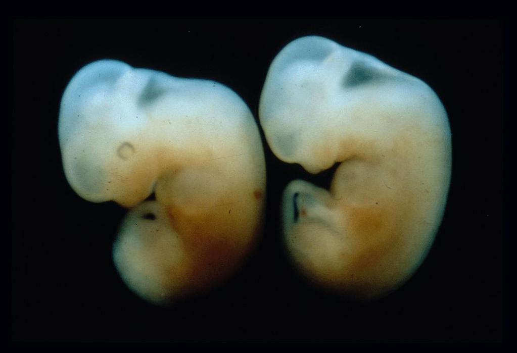 Fenotipo fetale
