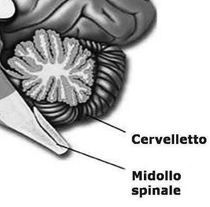 CERVELLETTO E' la seconda area più vasta dell'encefalo. E' costituito da due emisferi e da una porzione mediana, detta verme.