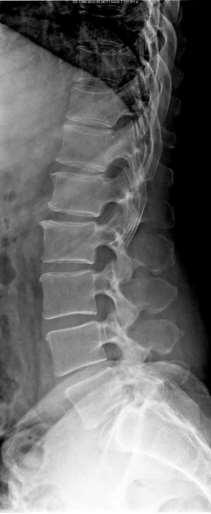 radiografico Fig.