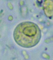 µm). Giardia intestinalis: ()