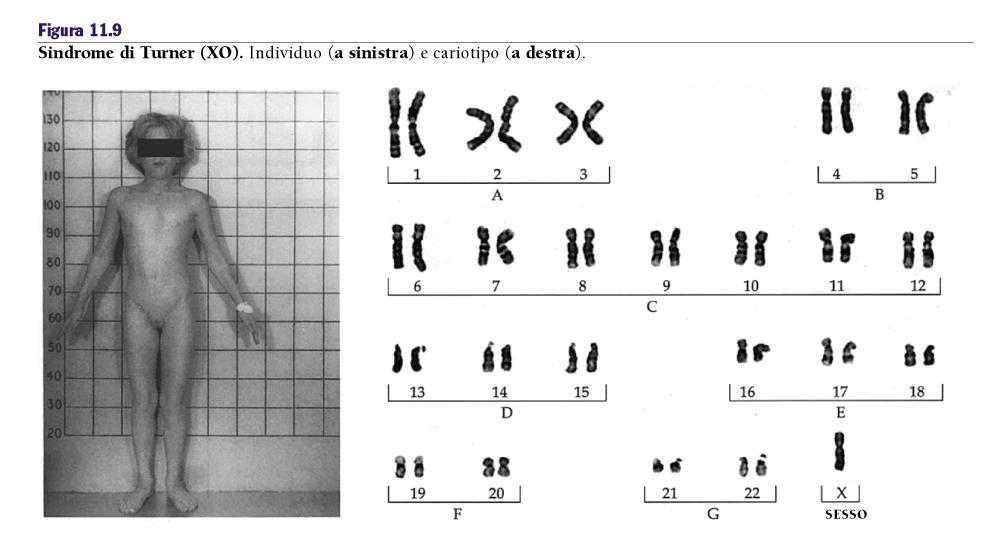 La determinazione del sesso nell uomo ed il ruolo del cromosoma Y