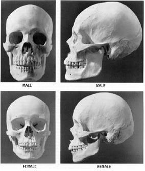 CRANIO FEMMINILE: PIU ARROTONDATO E GRACILE, SOPRATTUTTO NELLA REGIONE FACCIALE.