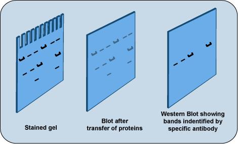 Northern e Southern blotting sono molto simili al Western blot nei principi.
