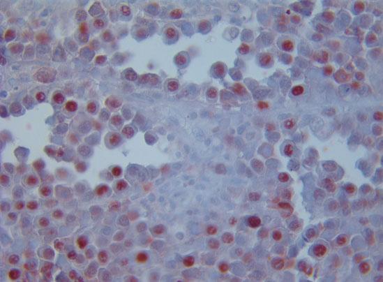 Immunohistochemistry Antibody (protein) Antigen (protein) In situ hybridization RNA/DNA probe (nucleic acid) mrna (nucleic acid) Ibridazione in