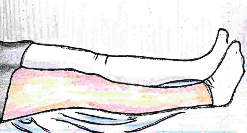 Abduzione dell anca In posizione supina con gli arti inferiori distesi e un cuscino tra le