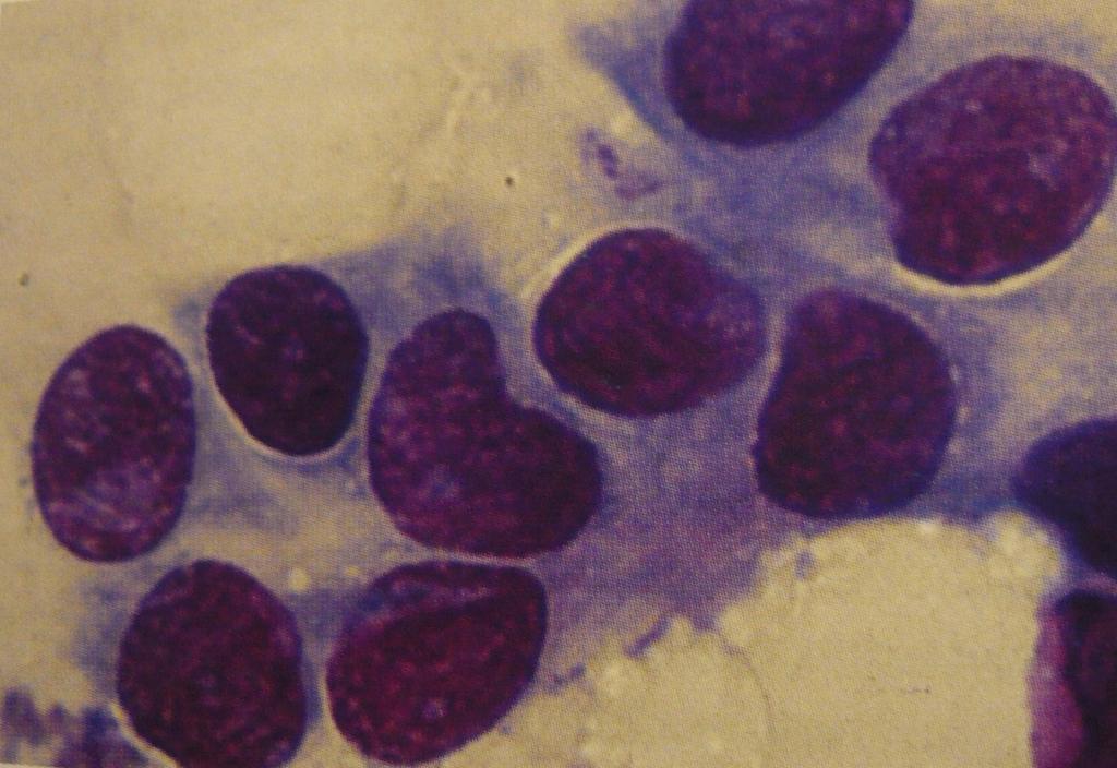 - macrofagi con pigmento ceroide: sono macrofagi deputati alla fagocitosi di materiale proveniente dall'attività secretoria della ghiandola mammaria, hanno dimensioni variabili da medie a molto